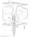 Fig. 08 - Reduced pressure augmentation of microfracture procedures for cartilage repair