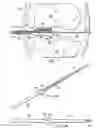 Fig. 09 - Reduced pressure augmentation of microfracture procedures for cartilage repair