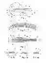 Fig. 02 - Device for the treatment of an ocular disease