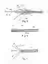 Fig. 03 - Device for the treatment of an ocular disease