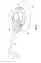 Fig. 07 - Insulin pump dermal infusion set having partially integrated mechanized cannula insertion with disposable activation portion