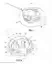 Fig. 08 - Insulin pump dermal infusion set having partially integrated mechanized cannula insertion with disposable activation portion