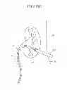 Fig. 02 - Hemostatic devices and methods for use thereof