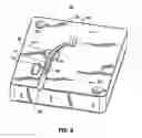 Fig. 07 - CATHETER AND CONNECTOR FOR USE WITH SAME