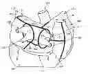 Fig. 01 - Methods of treating a cardiac arrhythmia by thoracoscopic production of a Cox maze III lesion set