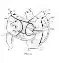 Fig. 05 - Methods of treating a cardiac arrhythmia by thoracoscopic production of a Cox maze III lesion set