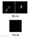 Fig. 07 - Method for enhanced photoepilation based on metallic nano-complexes