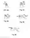 Fig. 10 - Methods and devices to treat nasal airways