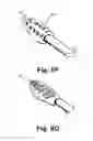 Fig. 11 - Methods and devices to treat nasal airways