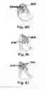 Fig. 12 - Methods and devices to treat nasal airways
