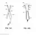 Fig. 18 - Methods and devices to treat nasal airways