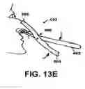 Fig. 19 - Methods and devices to treat nasal airways