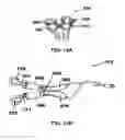 Fig. 20 - Methods and devices to treat nasal airways