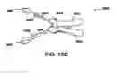 Fig. 22 - Methods and devices to treat nasal airways