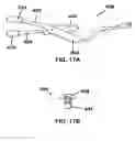 Fig. 24 - Methods and devices to treat nasal airways