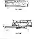 Fig. 38 - Methods and devices to treat nasal airways