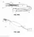 Fig. 39 - Methods and devices to treat nasal airways