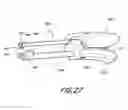 Fig. 41 - Methods and devices to treat nasal airways