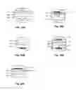 Fig. 42 - Methods and devices to treat nasal airways