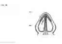 Fig. 50 - Methods and devices to treat nasal airways