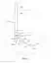 Fig. 22 - Denervation methods