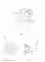 Fig. 07 - Fracturing calcifications in heart valves