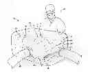 Fig. 01 - SYSTEM AND METHOD FOR PERFORMING SURGICAL PROCEDURES