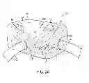Fig. 04 - SYSTEM AND METHOD FOR PERFORMING SURGICAL PROCEDURES