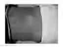 Fig. 09 - Skin Patch Instrument For Treating Pain
