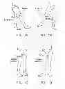Fig. 02 - Method and apparatus for attaching tissue to bone