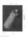 Fig. 35 - KNOTLESS SUTURE ANCHOR FOR SECURING SOFT TISSUE TO BONE