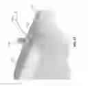 Fig. 50 - KNOTLESS SUTURE ANCHOR FOR SECURING SOFT TISSUE TO BONE