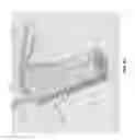 Fig. 66 - KNOTLESS SUTURE ANCHOR FOR SECURING SOFT TISSUE TO BONE