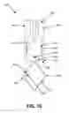 Fig. 69 - KNOTLESS SUTURE ANCHOR FOR SECURING SOFT TISSUE TO BONE