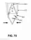 Fig. 74 - KNOTLESS SUTURE ANCHOR FOR SECURING SOFT TISSUE TO BONE