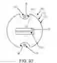 Fig. 93 - KNOTLESS SUTURE ANCHOR FOR SECURING SOFT TISSUE TO BONE