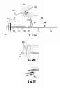 Fig. 06 - Intervertebral disc annulus repair system and bone anchor delivery tool