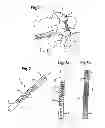 Fig. 02 - Rod-shaped implant element with flexible section