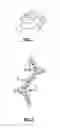 Fig. 02 - Spinal deformity correction instruments and methods