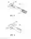 Fig. 03 - Insertion instrument for intervertebral implants