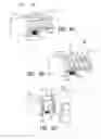 Fig. 05 - Insertion instrument for intervertebral implants