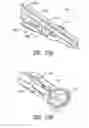 Fig. 12 - Insertion instrument for intervertebral implants