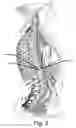Fig. 04 - Implantable device with responsive vascular and cardiac controllers
