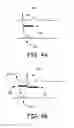 Fig. 05 - Use of preventative vagal stimulation in treatment of acute myocardial infarction or ischemia