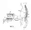 Fig. 03 - System and method for programming neurostimulation devices using cached plug-in software drivers