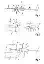 Fig. 02 - Releasable contact connection arrangement for electrodes on an electromedical device