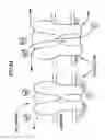 Fig. 07 - Neurostimulator