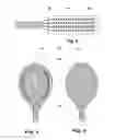 Fig. 04 - IMPLANTABLE INDIFFERENT ELECTRODE