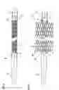 Fig. 03 - Implant delivery system with marker interlock