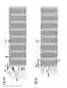 Fig. 09 - Implant delivery system with marker interlock